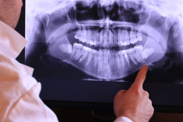 Best Emergency Dental Care for Broken or Chipped Teeth in La Conner, WA