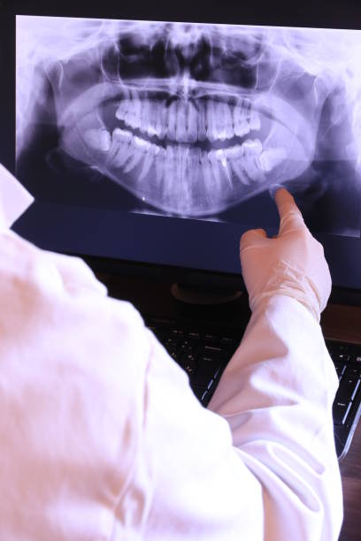 Best Emergency Treatment for Dental Infections or Abscesses in La Conner, WA